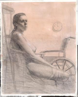 Womanwithleg